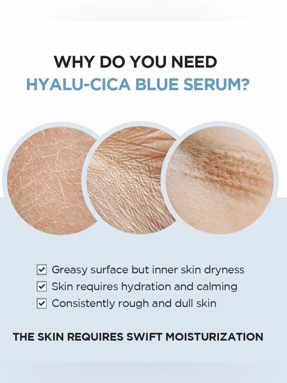 SKIN1004 K-beauty Madagascar Centella Hyalu-Cica Blue Serum - Blue